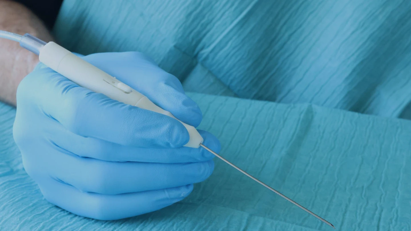 A gloved hand holding the Nordstar device over a surgical drape